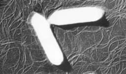 ボツリヌス菌の電子顕微鏡写真